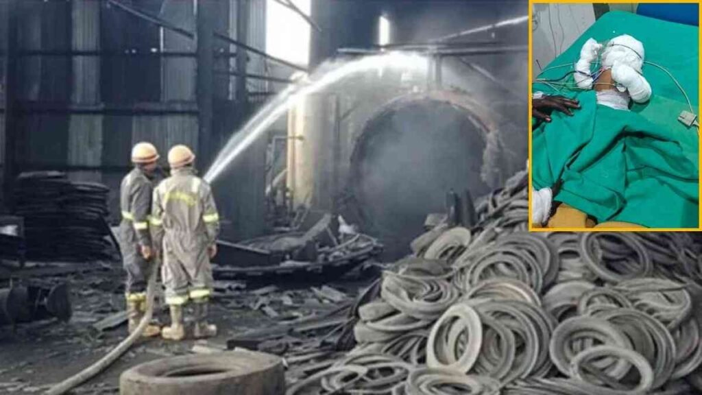 Raigarh Factory Blast : रायगढ़ औद्योगिक हादसा टायर फैक्ट्री ब्लास्ट में बच्ची की दर्दनाक मौत Raigarh Factory Blast
