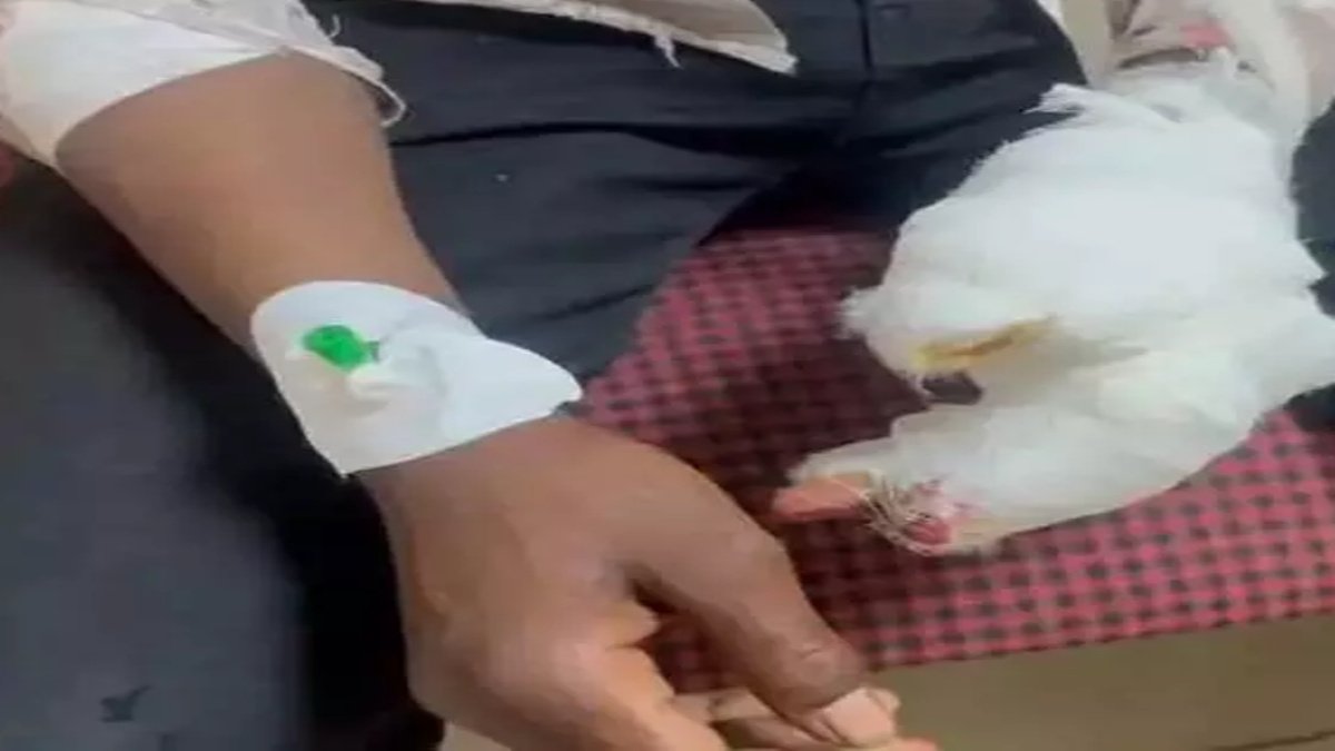 लापरवाही पड़ी भारी! गन्ना मशीन में फंसा किशोर का हाथ, चार उंगलियां गंभीर रूप से जख्मी