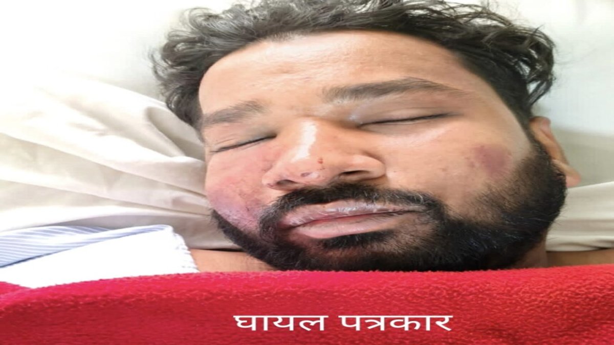 कोरबा में सनसनी’ ASI के बेटे को वाहन से कुचला, पत्रकार पर पिस्टल तानकर की फायरिंग