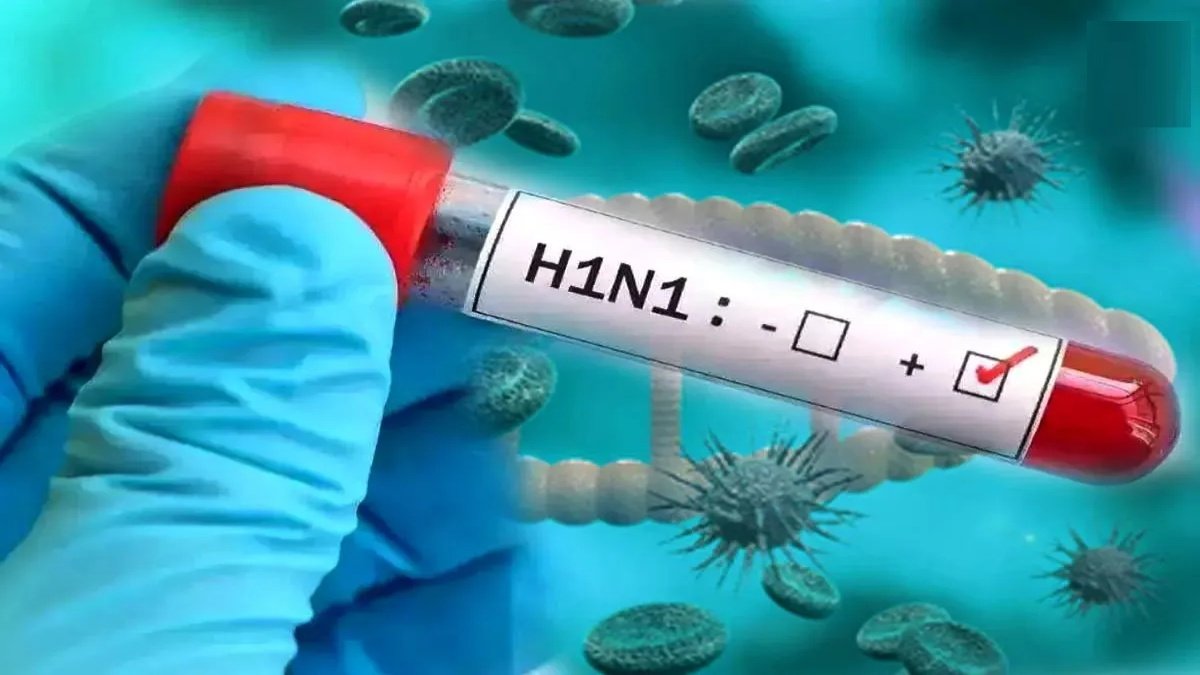 Swine Flu Alert : छत्तीसगढ़ में स्वाइन फ्लू का बढ़ता खतरा, 158 मरीजों की पुष्टि’ स्वास्थ्य विभाग ने जारी की एडवाइजरी